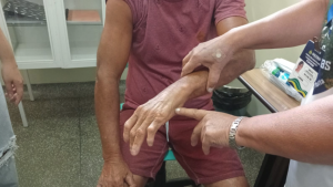 Em seis meses, Dermato Saúde realizou mais de 13 mil exames dermatológicos no interior do Amazonas 7_Foto Arnoldo Santos Fuham
